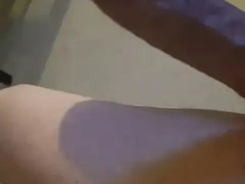 Third leg treatment anyone? (20)